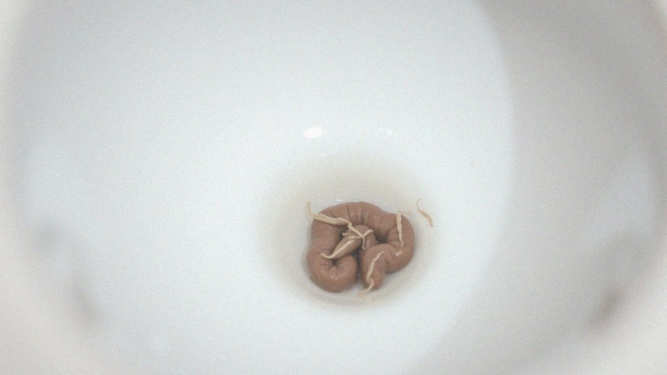 Martwy owsik w kale – co oznacza jego obecność?